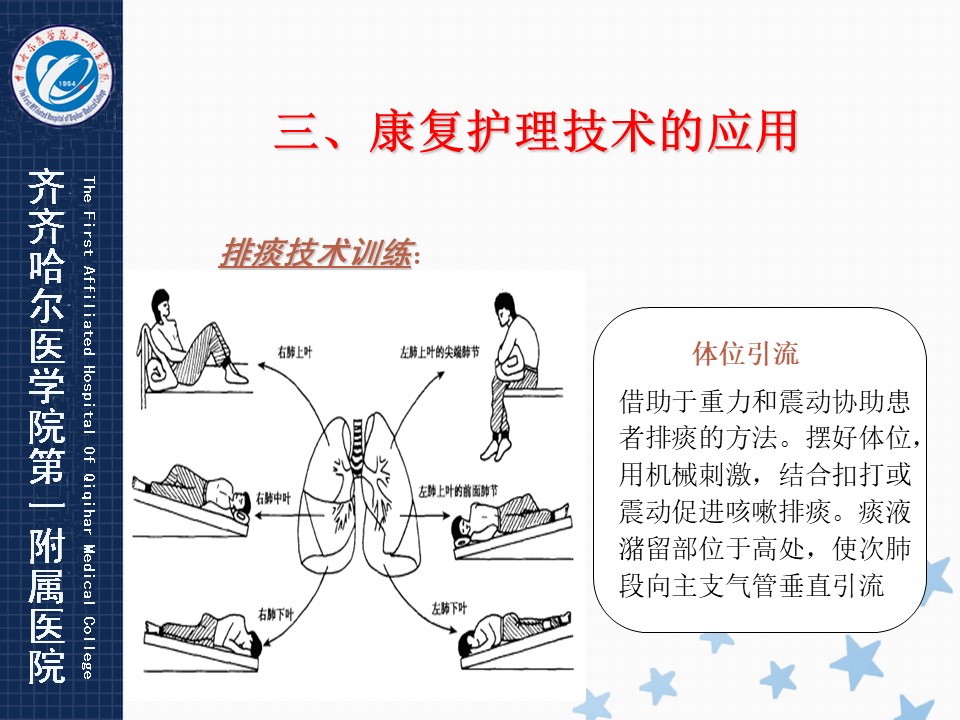 最新康復(fù)護(hù)理技術(shù)重塑護(hù)理領(lǐng)域新篇章